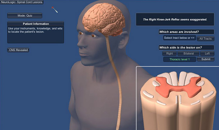 NeuroLogic